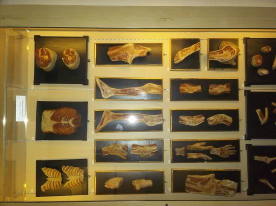 Luigi Cattaneo Anatomical Wax Museum